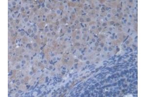 Detection of VARS in Mouse Ovary Tissue using Polyclonal Antibody to Valyl tRNA Synthetase (VARS) (VARS 抗体  (AA 186-421))