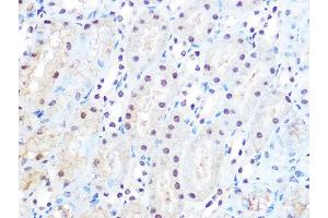 Immunohistochemistry of paraffin-embedded mouse kidney using p38 MAPK Rabbit mAb (ABIN7268614) at dilution of 1:100 (40x lens).