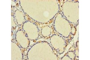 Immunohistochemistry (IHC) image for anti-C1D Nuclear Receptor Corepressor (C1D) (AA 1-135) antibody (ABIN7161811)