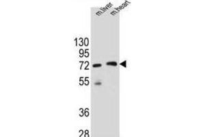 Western Blotting (WB) image for anti-Potassium Channel Tetramerisation Domain Containing 8 (KCTD8) antibody (ABIN2996279) (KCTD8 抗体)