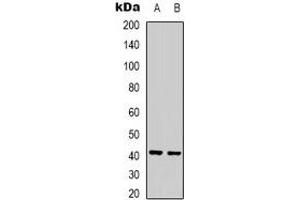 Western blot analysis of Ghrelin Receptor expression in Jurkat (A), rat liver (B) whole cell lysates. (GHSR 抗体)