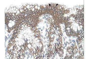 TARS antibody was used for immunohistochemistry at a concentration of 4-8 ug/ml. (TARS 抗体  (N-Term))