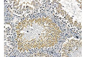 ABIN7095431 and ABIN7099488 at 1/100 staining rat testis tissue by IHC-P. (OSBPL5 抗体)