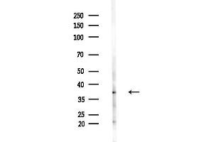 anti-Pyruvate Dehydrogenase beta (PDHB) (N-Term) antibody