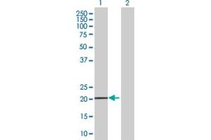 Western Blot analysis of MS4A4A expression in transfected 293T cell line by MS4A4A MaxPab polyclonal antibody. (MS4A4A 抗体  (AA 1-220))