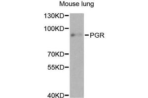 Western blot analysis of extracts of mouse lung, using PGR antibody. (Progesterone Receptor 抗体)