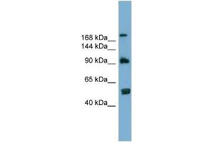 WB Suggested Anti-ATG2A  Antibody Titration: 0. (ATG2A 抗体  (N-Term))