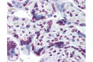 Anti-RBM5 antibody IHC of human placenta. (RBM5 抗体  (AA 75-184))