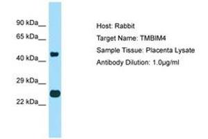 Image no. 1 for anti-Transmembrane BAX Inhibitor Motif Containing 4 (TMBIM4) (AA 110-159) antibody (ABIN6750079) (TMBIM4 抗体  (AA 110-159))