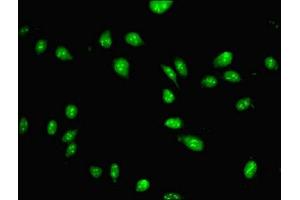 Immunofluorescence (IF) image for anti-Paired Box 3 (PAX3) (AA 90-184) antibody (ABIN7162495)