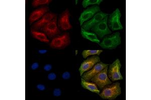 ABIN6263822 and ABIN6272378 staining Hela cells by IF/ICC. (OMG 抗体  (Internal Region))