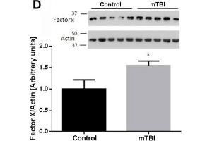 At two weeks upon injury, brain thrombin activity and concentration are similar between mTBI exposed animals and controls. (Factor 10 Heavy Chain (AA 351-448) 抗体)
