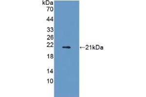 Western blot analysis of recombinant Rat ADIPoR2. (Adiponectin Receptor 2 抗体  (AA 1-147))