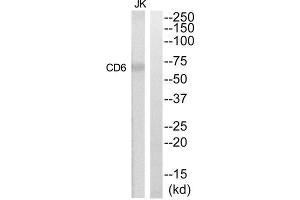 Western Blotting (WB) image for anti-CD6 (CD6) (Internal Region) antibody (ABIN1852260) (CD6 抗体  (Internal Region))