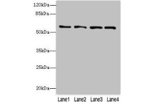 Western blot All lanes: FLAD1 antibody at 4 μg/mL Lane 1: K562 whole cell lysate Lane 2: HepG2 whole cell lysate Lane 3: MDA-MB-231 whole cell lysate Lane 4: Hela whole cell lysate Secondary Goat polyclonal to rabbit IgG at 1/10000 dilution Predicted band size: 66, 55, 50, 33, 37 kDa Observed band size: 66 kDa (FAD Synthetase 抗体  (AA 1-490))