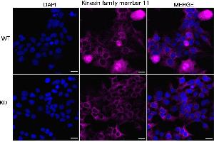 Immunocytochemical staining of 293T cells using Kinesin family member 11 antibody (ABIN7799200), 1:1,000), Top panel: wild-type (WT), Bottom panal: Kinesin family member 11 shRNA knockdown (KD). (Recombinant KIF11 抗体)