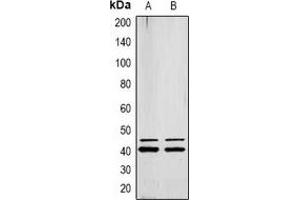 Western blot analysis of ERK1/2 (pY222/205) expression in MCF7 (A), Jurkat (B) whole cell lysates.