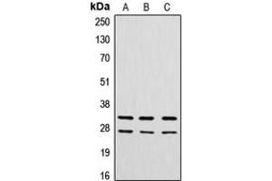 Western blot analysis of Cathepsin G expression in A549 (A), MCF7 (B), rat heart (C) whole cell lysates.