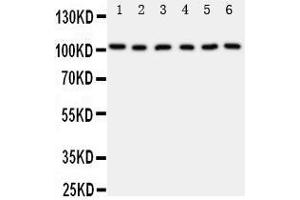 Western Blotting (WB) image for anti-Minichromosome Maintenance Complex Component 2 (MCM2) (AA 884-904), (C-Term) antibody (ABIN3044274) (MCM2 抗体  (C-Term))