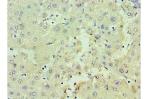 Immunohistochemistry of paraffin-embedded human liver tissue using ABIN7162980 at dilution of 1:100 (HSD17B4 抗体  (AA 437-736))