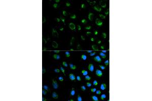 Immunofluorescence analysis of MCF7 cell using FXN antibody. (Frataxin 抗体)