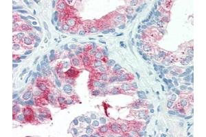 Human Prostate (formalin-fixed, paraffin-embedded) stained with ANXA1at 20 µg/ml followed by biotinylated goat anti-rabbit IgG secondary antibody, alkaline phosphatase-streptavidin and chromogen. (Annexin a1 抗体  (N-Term))