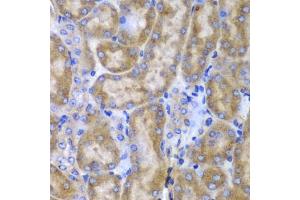 Immunohistochemistry of paraffin-embedded mouse kidney using SPARC antibody (ABIN3022250, ABIN3022251, ABIN1513555 and ABIN6218694) at dilution of 1:100 (40x lens).
