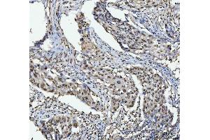 IHC analysis of hnRNP L/HNRNPL using anti-hnRNP L/HNRNPL antibody (ABIN7600130).