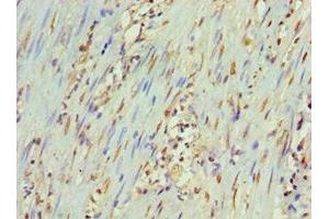 Immunohistochemistry (IHC) image for anti-Protein Phosphatase 1, Regulatory (Inhibitor) Subunit 1B (PPP1R1B) (AA 1-168), (Regulatory Subunit 1B) antibody (ABIN7165931)