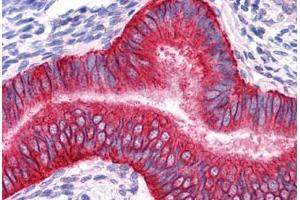 Human Uterus: Formalin-Fixed, Paraffin-Embedded (FFPE) (EpCAM 抗体)