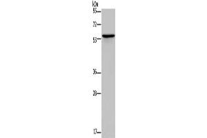 Gel: 10 % SDS-PAGE, Lysate: 40 μg, Lane: Human lung cancer tissue, Primary antibody: ABIN7189699(ADRA1B Antibody) at dilution 1/550, Secondary antibody: Goat anti rabbit IgG at 1/8000 dilution, Exposure time: 1 minute (ADRA1B 抗体)