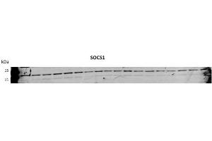 SOCS1 antibody - N-terminal region  validated by WB using Huh7 Cells transfected with microRNA at 1:1000. (SOCS1 抗体  (N-Term))