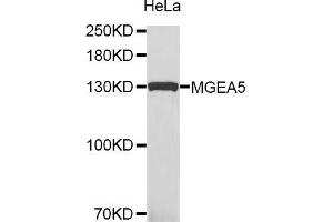 Western blot analysis of extracts of HeLa cells, using MGEA5 antibody. (MGEA5 抗体)
