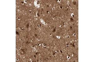 Immunohistochemical staining (Formalin-fixed paraffin-embedded sections) of human cerebral cortex with MT3 polyclonal antibody  shows strong nuclear and cytoplasmic positivity in neuronal cells and glial cells. (MT3 抗体)