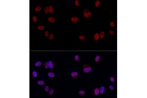 Immunofluorescence analysis of A-549 cells using YE Rabbit pAb (ABIN6130808, ABIN6150331, ABIN6150332 and ABIN6221925) at dilution of 1:50 (40x lens). (GAS41 抗体  (AA 1-227))