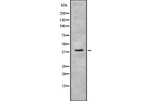 Western blot analysis IDH3B using NIH-3T3 whole cell lysates (IDH3B 抗体  (N-Term))