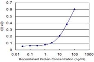 Detection limit for recombinant GST tagged RORC is 1 ng/ml as a capture antibody. (RORC 抗体  (AA 412-517))