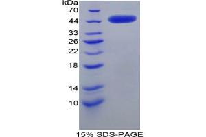 SDS-PAGE analysis of Rat CRH Protein. (CRH 蛋白)