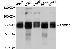 Western blot analysis of extracts of various cell lines, using ACBD5 antibody. (ACBD5 抗体)