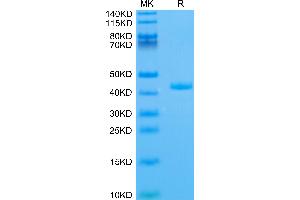 Human APOA2 on Tris-Bis PAGE under reduced condition. (APOA2 Protein (AA 19-100) (Fc Tag))
