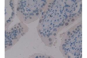 Detection of ELOA in Mouse Vas Deferens Tissue using Polyclonal Antibody to Elongin A (ELOA)
