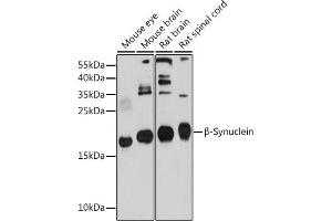 Western blot analysis of extracts of various cell lines, using β-Synuclein antibody (ABIN6127517, ABIN6148193, ABIN6148194 and ABIN6214698) at 1:1000 dilution. (beta Synuclein 抗体  (AA 1-134))