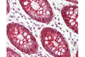 Immunohistochemistry (Paraffin-embedded Sections) (IHC (p)) image for anti-Solute Carrier Family 39 (Metal Ion Transporter), Member 5 (SLC39A5) (N-Term) antibody (ABIN6756565)