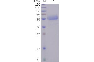 SDS-PAGE (SDS) image for Inducible T-Cell Co-Stimulator (ICOS) (AA 21-140) protein (Fc Tag) (ABIN6961167)