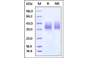 SDS-PAGE (SDS) image for V-Set Domain Containing T Cell Activation Inhibitor 1 (VTCN1) (AA 33-194) protein (His tag,AVI tag,Biotin) (ABIN4949005)