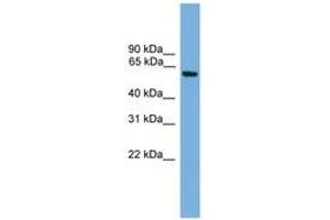 Image no. 1 for anti-Kruppel-Like Factor 11 (KLF11) (AA 151-200) antibody (ABIN6744644) (KLF11 抗体  (AA 151-200))