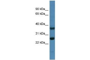 Western Blotting (WB) image for anti-ATP Synthase, H+ Transporting, Mitochondrial Fo Complex, Subunit B1 (ATP5F1) (N-Term) antibody (ABIN2783270)