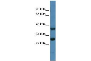 WB Suggested Anti-Atp5f1 Antibody Titration: 0.