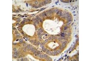 Immunohistochemistry (IHC) image for anti-Transient Receptor Potential Cation Channel, Subfamily M, Member 8 (TRPM8) (AA 69-98) antibody (ABIN3029241)