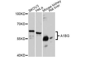 Western blot analysis of extracts of various cell lines, using A1BG Antibody (ABIN5997159) at 1:3000 dilution. (A1BG 抗体)